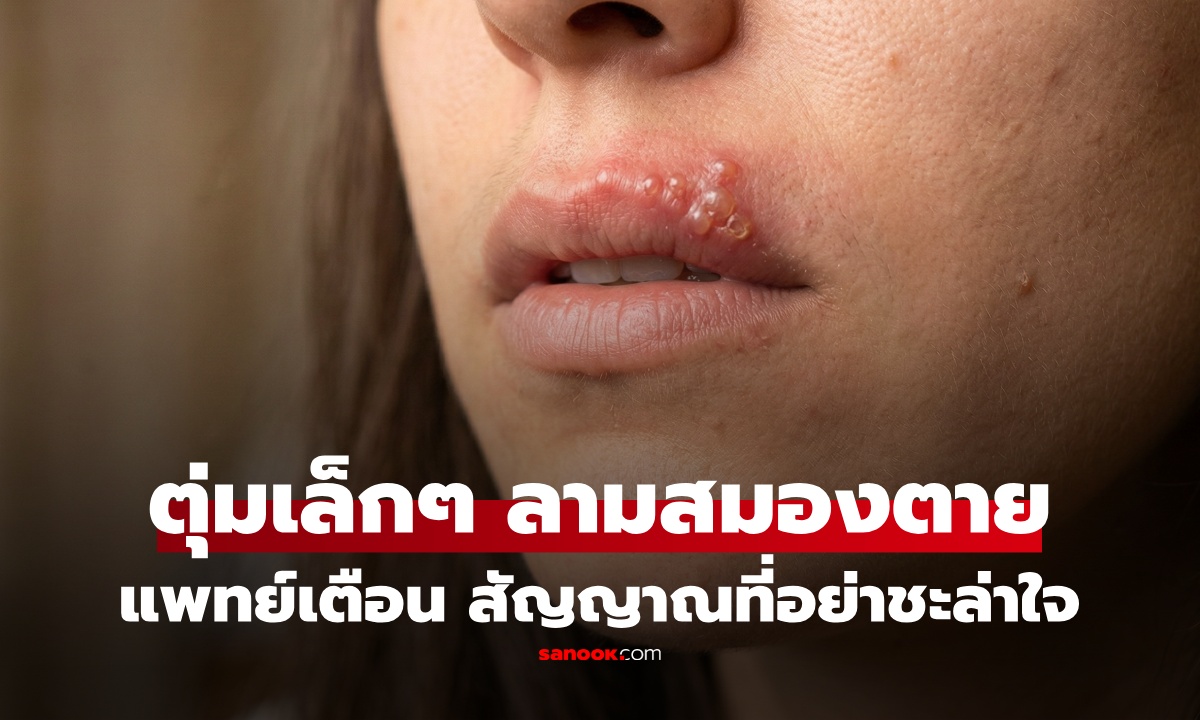 Опасные пузырьки: Как герпес на губе может привести к смерти мозга